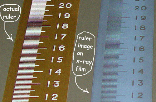 ruler_&_x-ray_image.jpg (55034 bytes)
